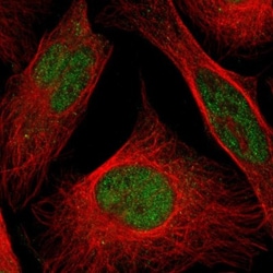 CLP1/HEAB Antibody, Novus Biologicals 0.1mL; Unlabeled:Antibodies, Polyclonal
